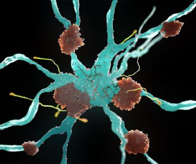 ADHD Linked to Late-Life Dementia